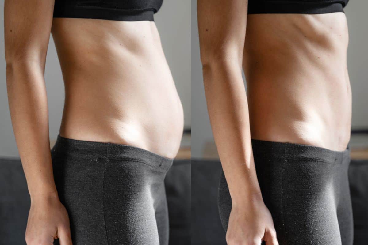 Post-Pregnancy: What Happens to Your Abdominal Muscles After Birth Luton