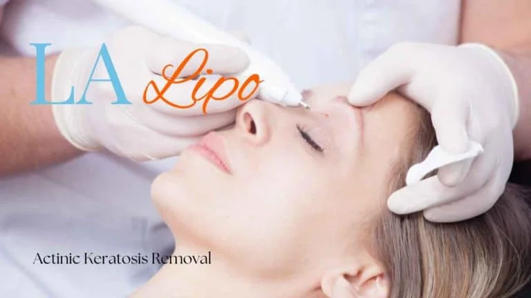 Woman receiving Actinic Keratosis Removal Treatment Luton
