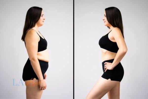 LA-EMS Body Sculpting Luton results before and after of womans results on body toning.