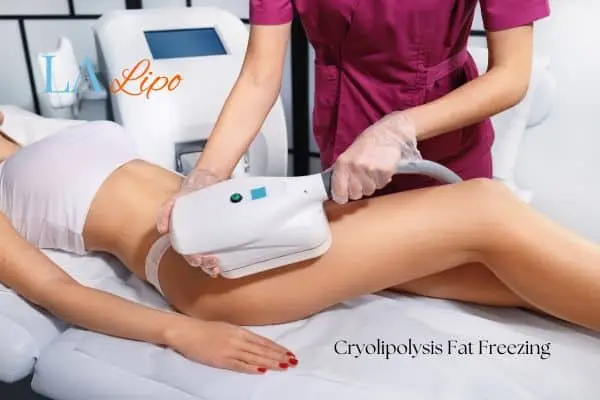 Woman receiving coolsculpting Luton treatment on her thighs