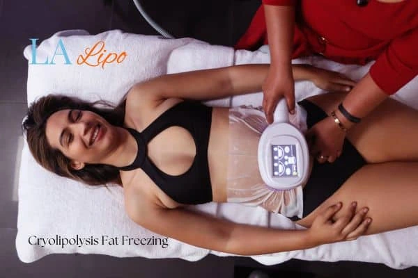 woman getting cryolipolysis Luton