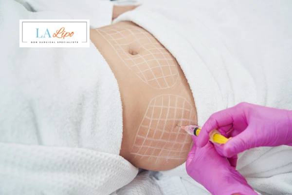 aqualyx fat dissolving injections Luton