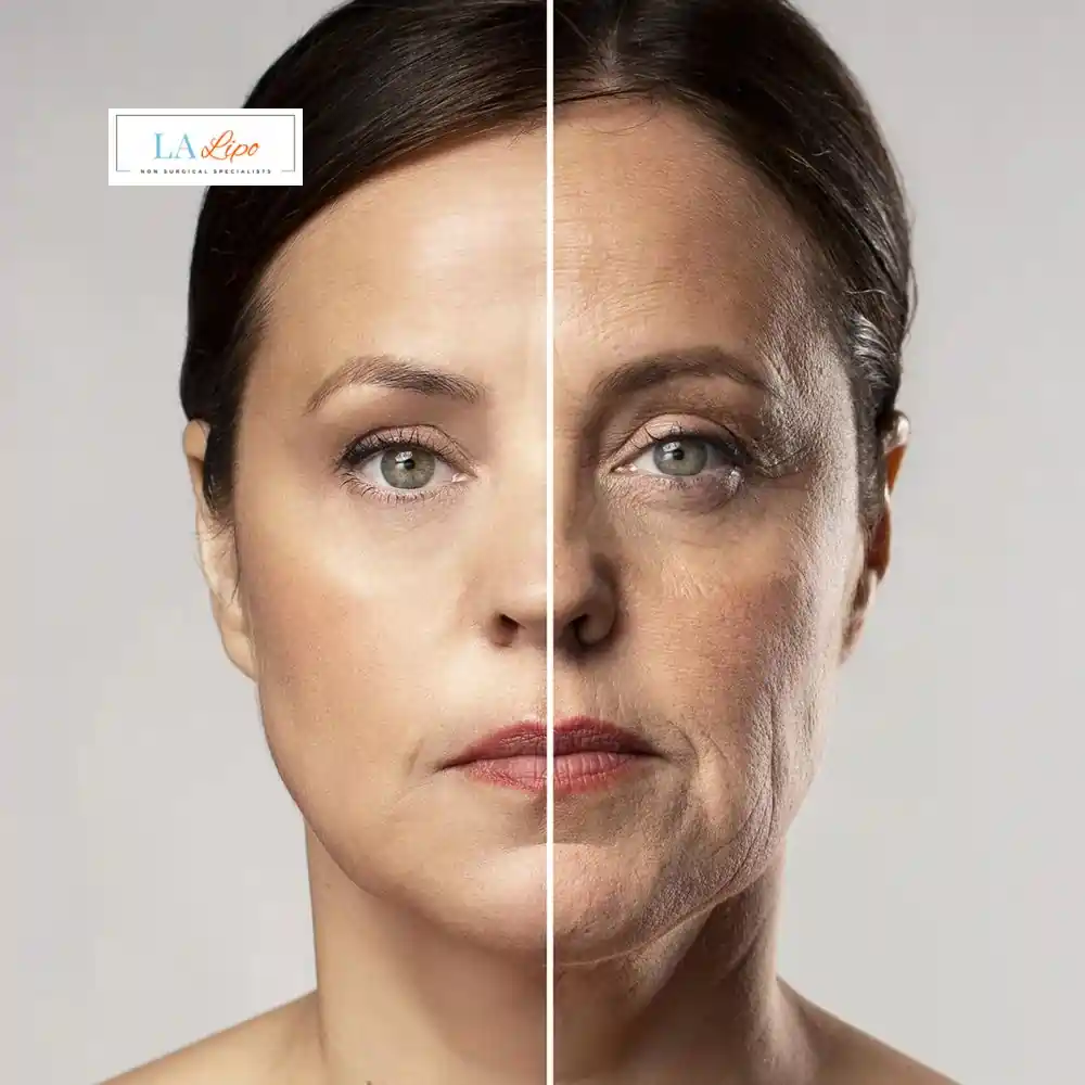 How Can You Tell If Non-Surgical Skin Tightening Is Right for You Luton?