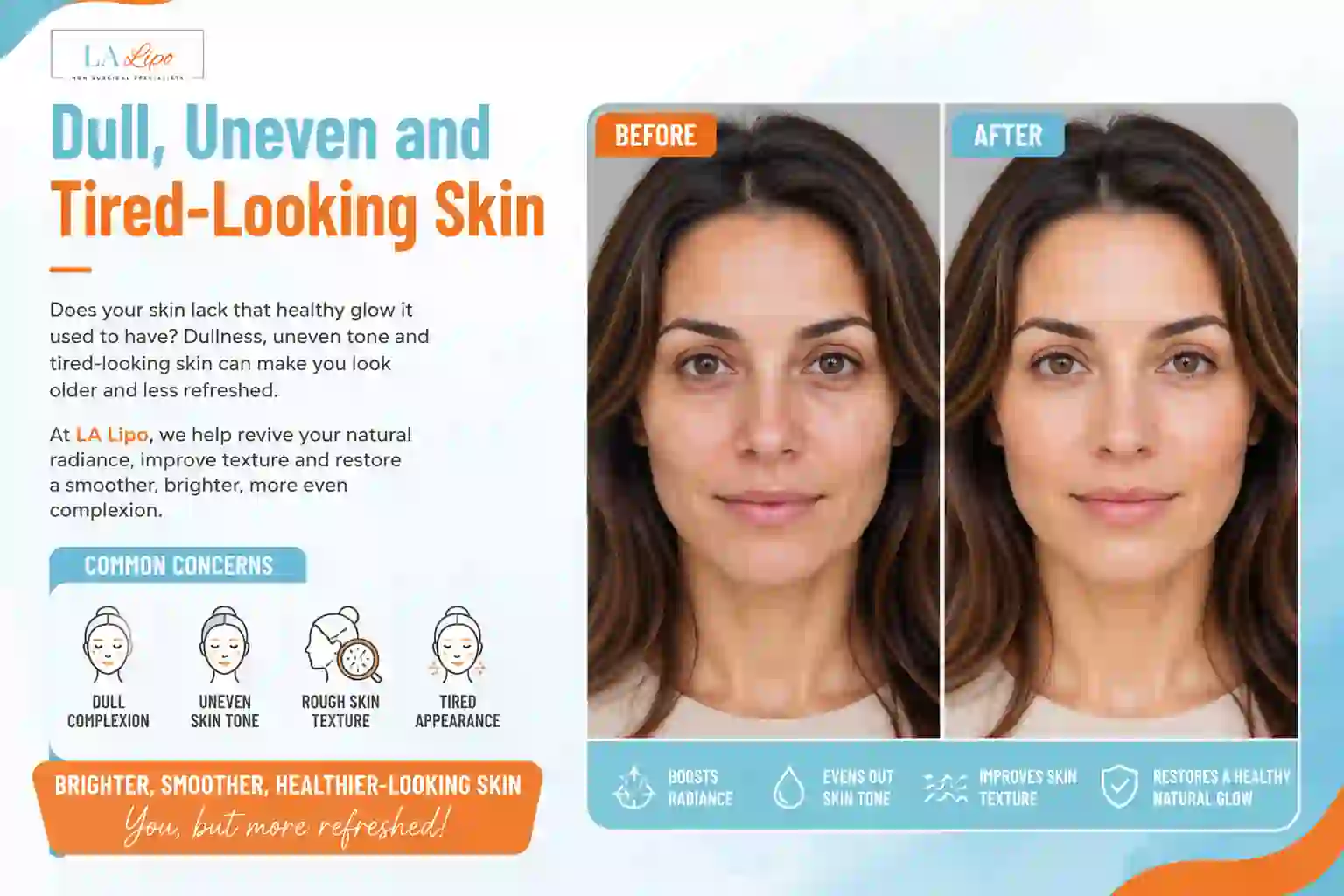 Sign #5: Dull, Uneven and Tired-Looking Skin Luton