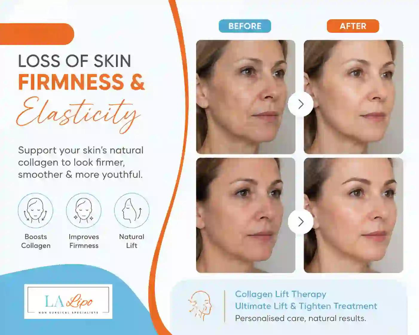 Sign #7: Loss of Skin Firmness and Elasticity Luton