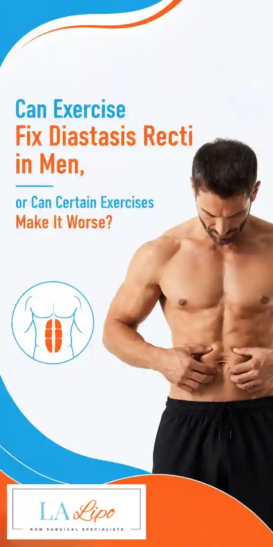 Can Exercise Fix Diastasis Recti in Men, or Can Certain Exercises Make It Worse Luton?